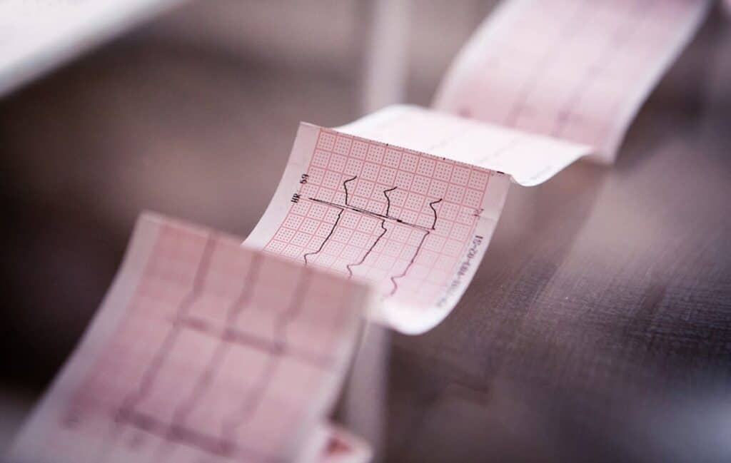 ECG/EKG test result strip clinical biotechnology
